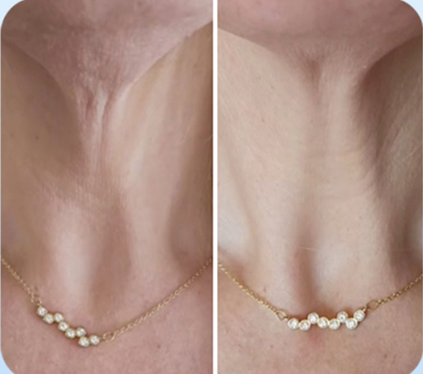 GoPure Cuello Rescatado